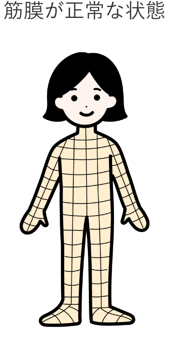 筋膜が正常なイメージのイラスト